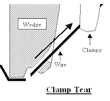 Clamp Tear